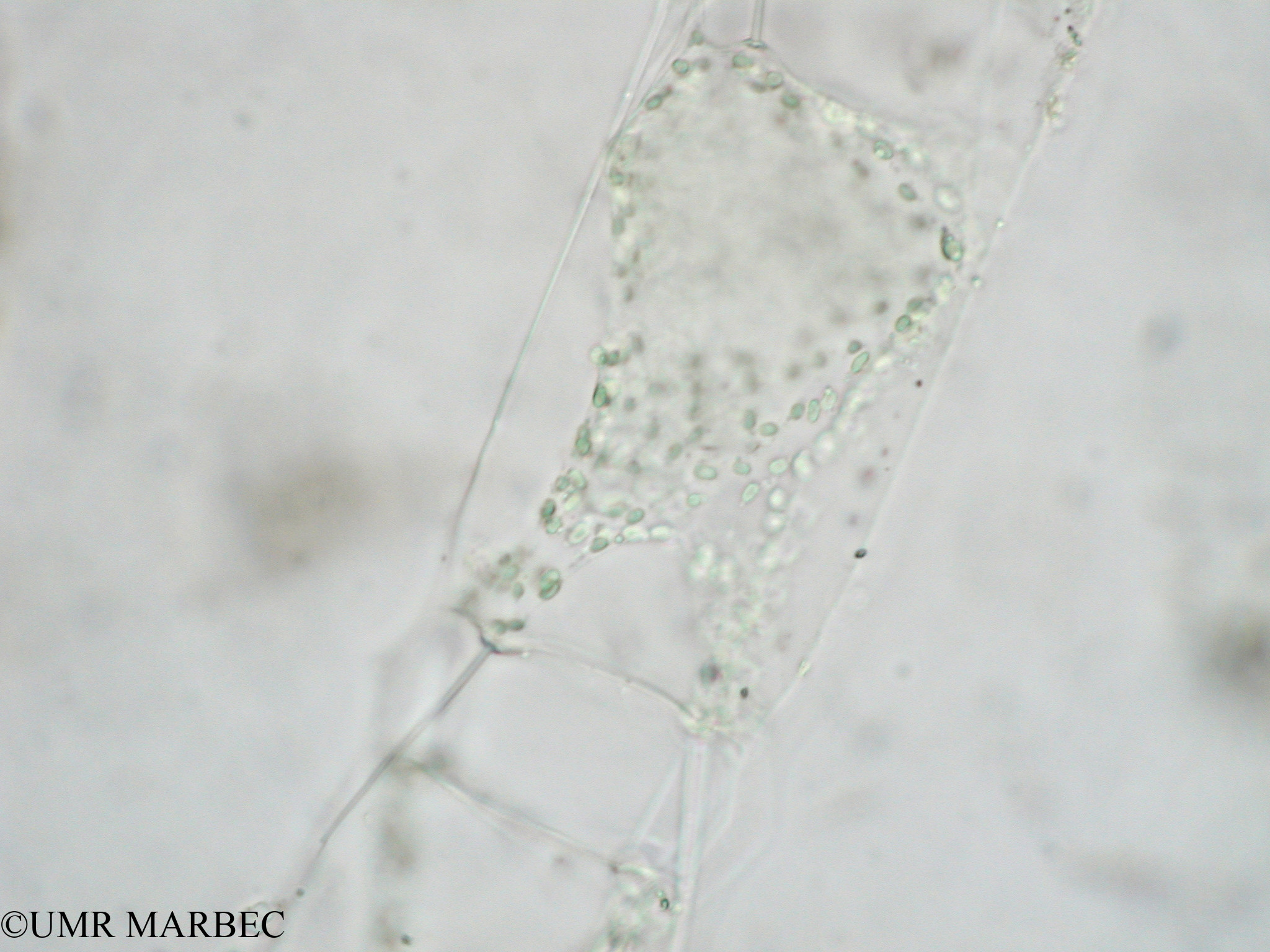 phyto/Tulear Lagoon/all/ICAR2 Avril 2008/Odontella sinensis (Odontella sp2 d)(copy).jpg